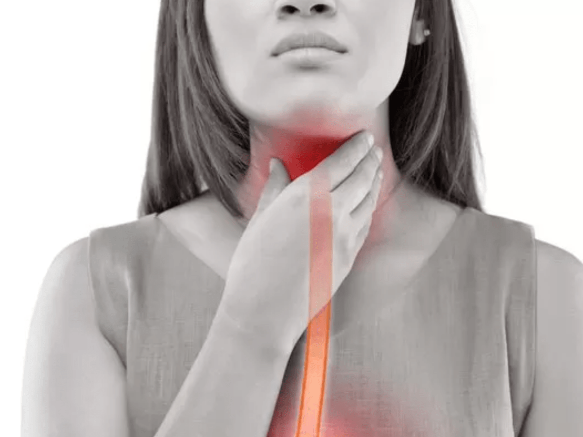 My Life with Achalasia: Misdiagnoses, Misadventures, and All the&nbsp;Rest